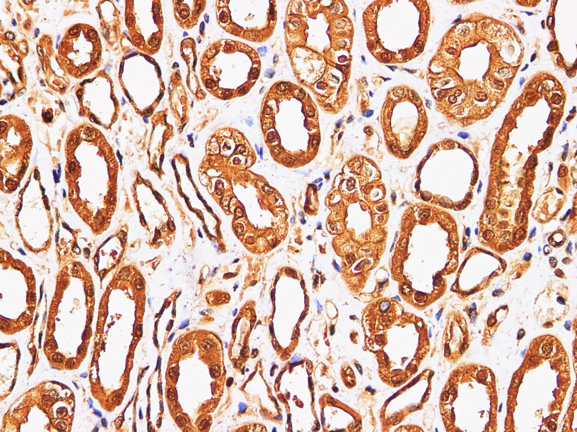 Polyclonal Rabbit anti-Rat S100A9 / MRP14 Antibody (IHC, WB)