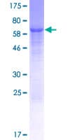 Human WDR73 Protein (Recombinant GST)
