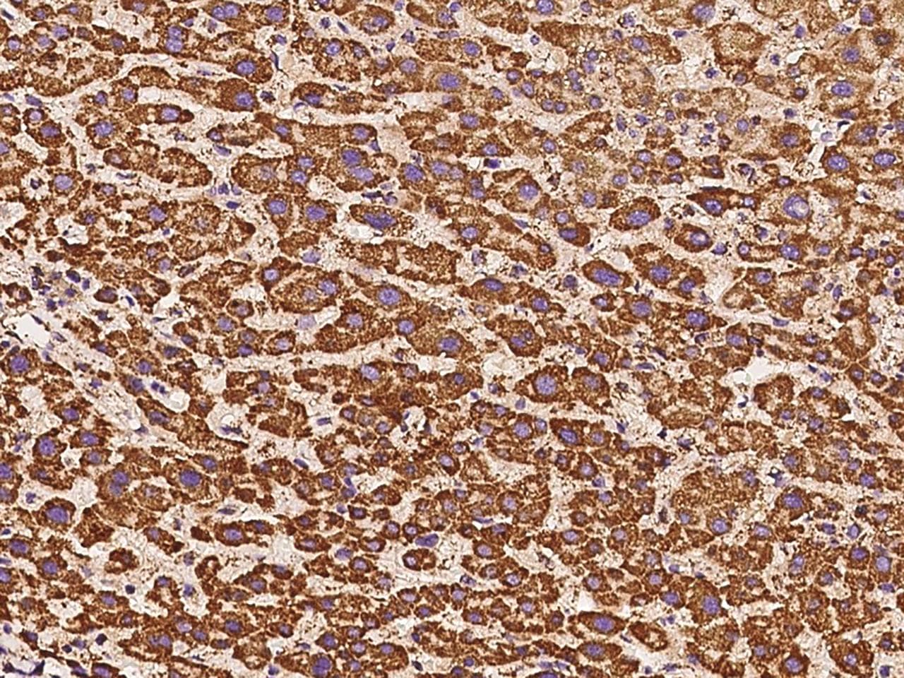 ATP5H Antibody