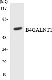 Polyclonal Rabbit anti-Human B4GALNT1 / GM2/GD2 Synthase Antibody (aa274-323, WB)