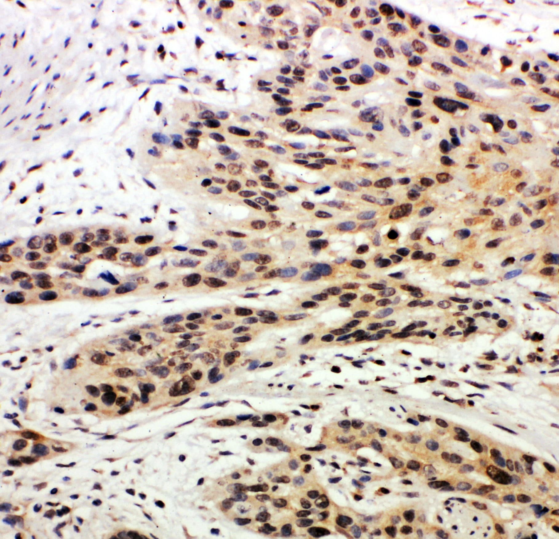 CASP14 / Caspase 14 Antibody (aa223-242)