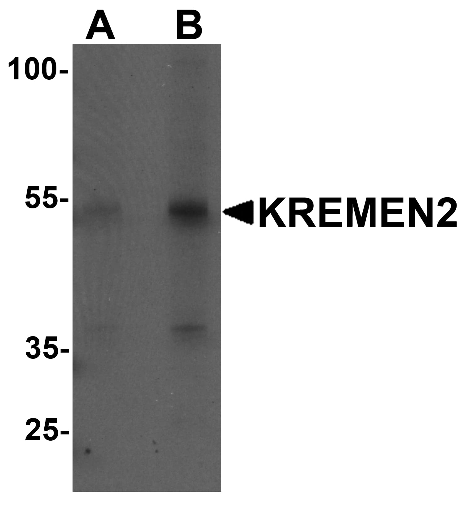 KREMEN2 Antibody