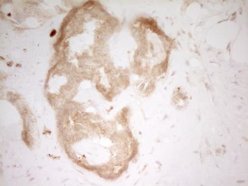 Monoclonal Mouse anti-Human TFPI / LACI Antibody (clone OTI5A2, aa29-304, IHC, WB)