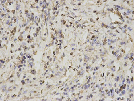 IHC-plus™ Polyclonal Rabbit anti-Human PSMA1 Antibody (IHC, IF, WB)