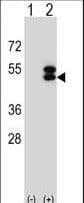 ATXN3 / JOS Antibody (aa261-288)