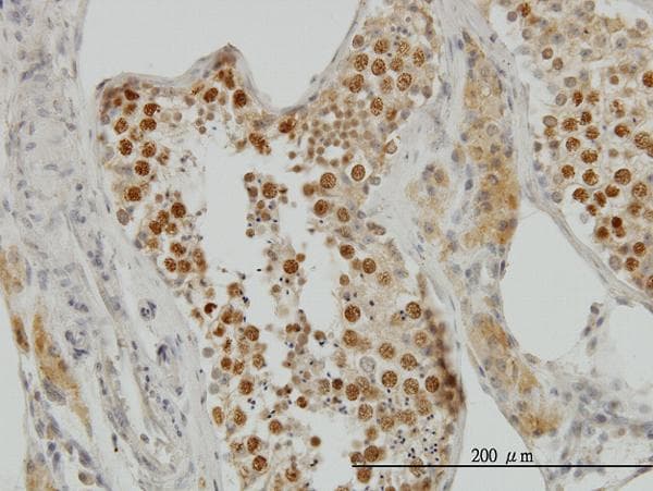 TOP2A / Topoisomerase II Alpha Antibody (clone 1E2)