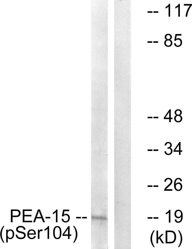 Polyclonal Rabbit anti-Human PEA15 / PEA-15 Antibody (phospho-Ser104, IHC, WB)