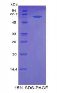 Human THBS4 / Thrombospondin 4 Protein (Recombinant His-GST)