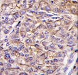 TAOK3 / JIK Antibody (aa671-700)