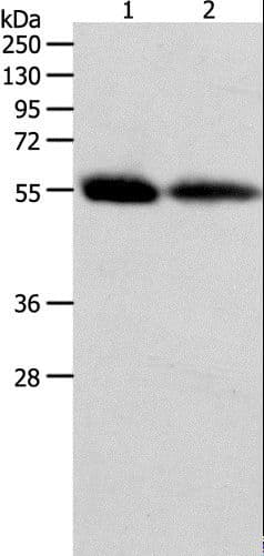 MMP11 Antibody
