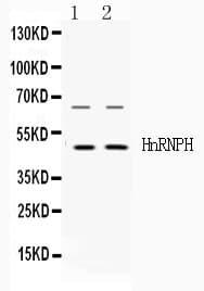 HNRNPH1 / hnRNP H Antibody