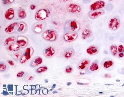 PathPlus™ Polyclonal Rabbit anti-Human ADAMTS5 Antibody (C-Terminus, IHC)