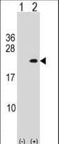Polyclonal Rabbit anti-Human PLA2G12A Antibody (aa55-83, WB)