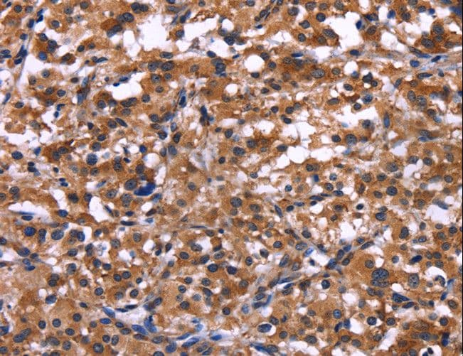 IL1A / IL-1 Alpha Antibody