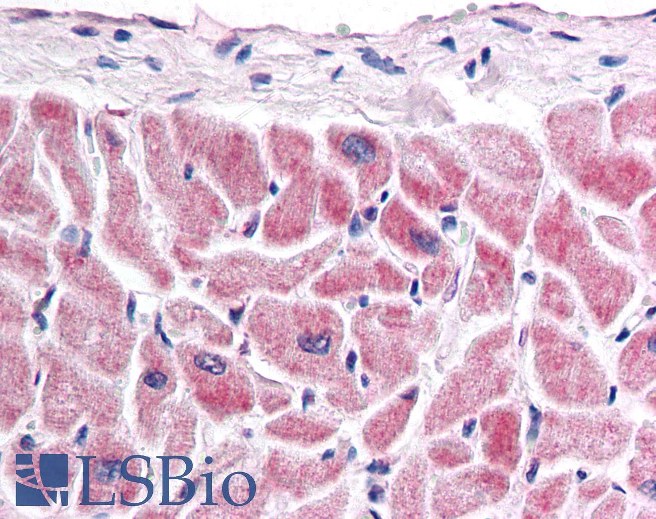 IHC-plus™ FZD7 / Frizzled 7 Antibody (C-Terminus)