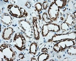 SRR / Serine Racemase Antibody (clone OTI2E3)