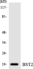 Polyclonal Rabbit anti-Human BST2 Antibody (aa65-114, WB)