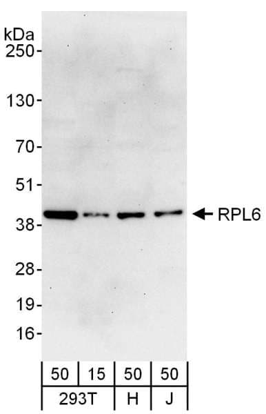 RPL6 / Ribosomal Protein L6 Antibody (aa125-175)