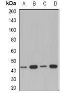 ACAA1 Antibody