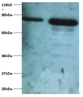 OTUB1 / OTU1 Antibody