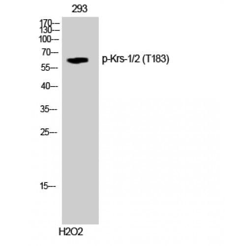Polyclonal Rabbit anti-Human STK3 / STK4 Antibody (120-200 aa, IHC, WB)
