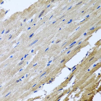 CAMK2G / CaMK II Gamma Antibody