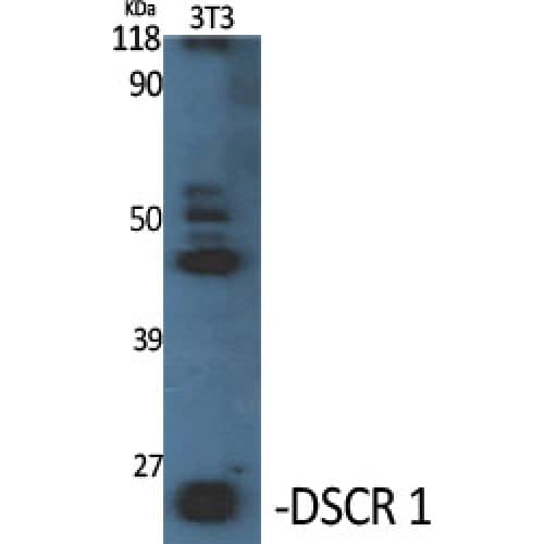 Polyclonal Rabbit anti-Human RCAN1 / DSCR1 Antibody (180-260 aa, C-terminal, WB)
