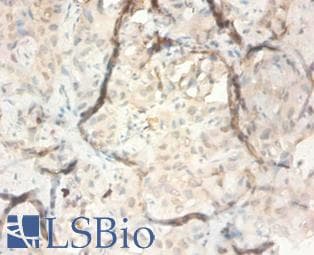 SERPINB3 Antibody