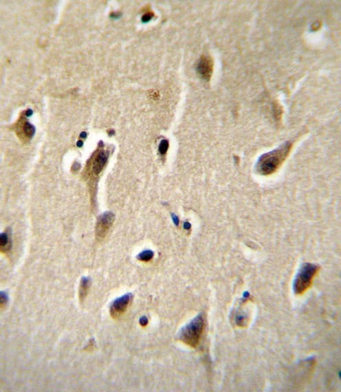 DCK / Deoxycytidine kinase Antibody (aa171-200)