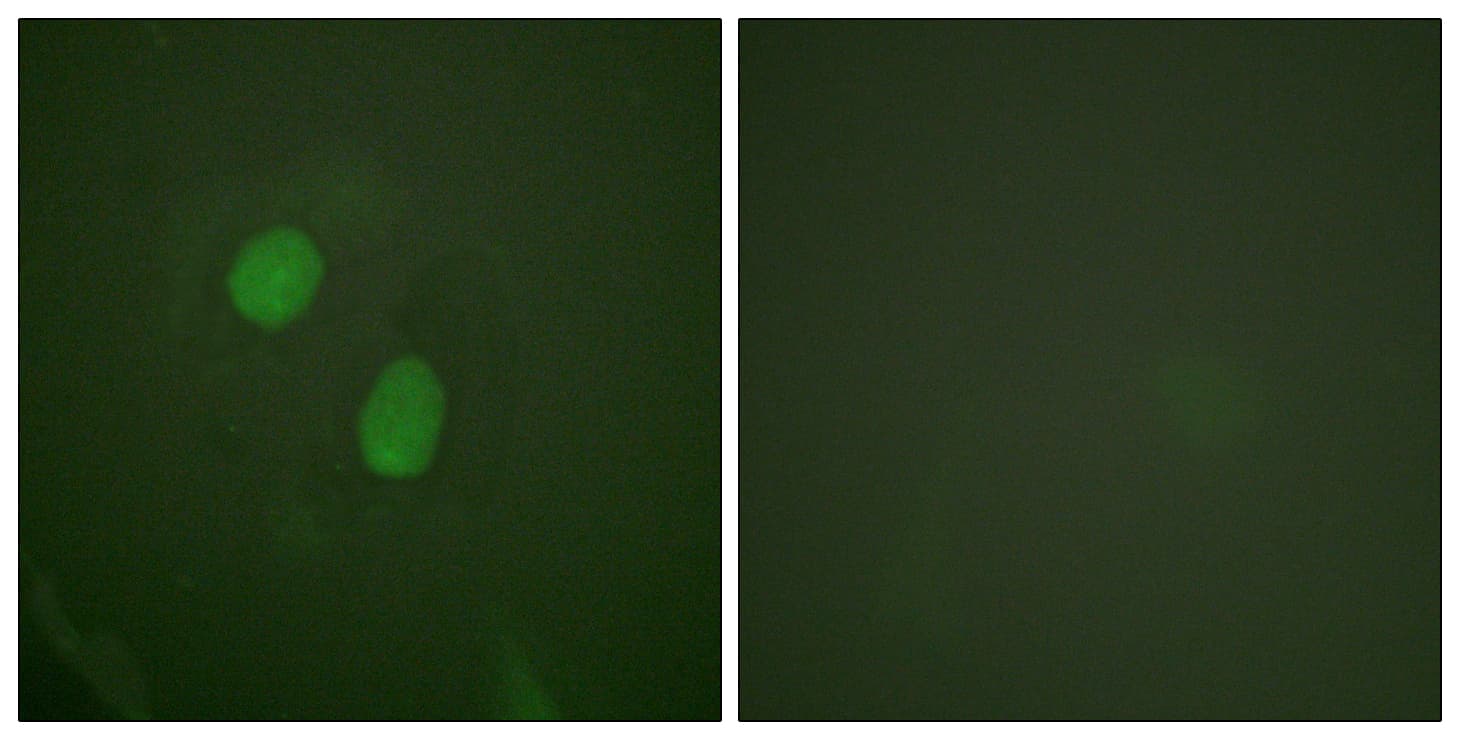 ER Alpha / Estrogen Receptor Antibody (phospho-Ser305)