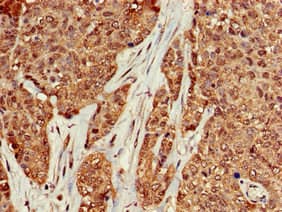 KRAS Antibody (aa2-168)