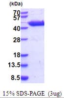 Mouse Aspartate Aminotransferase Protein (Recombinant His)