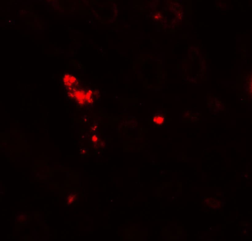 IHC-plus™ Polyclonal Rabbit anti-Human NOX3 Antibody (IHC, IF, WB)