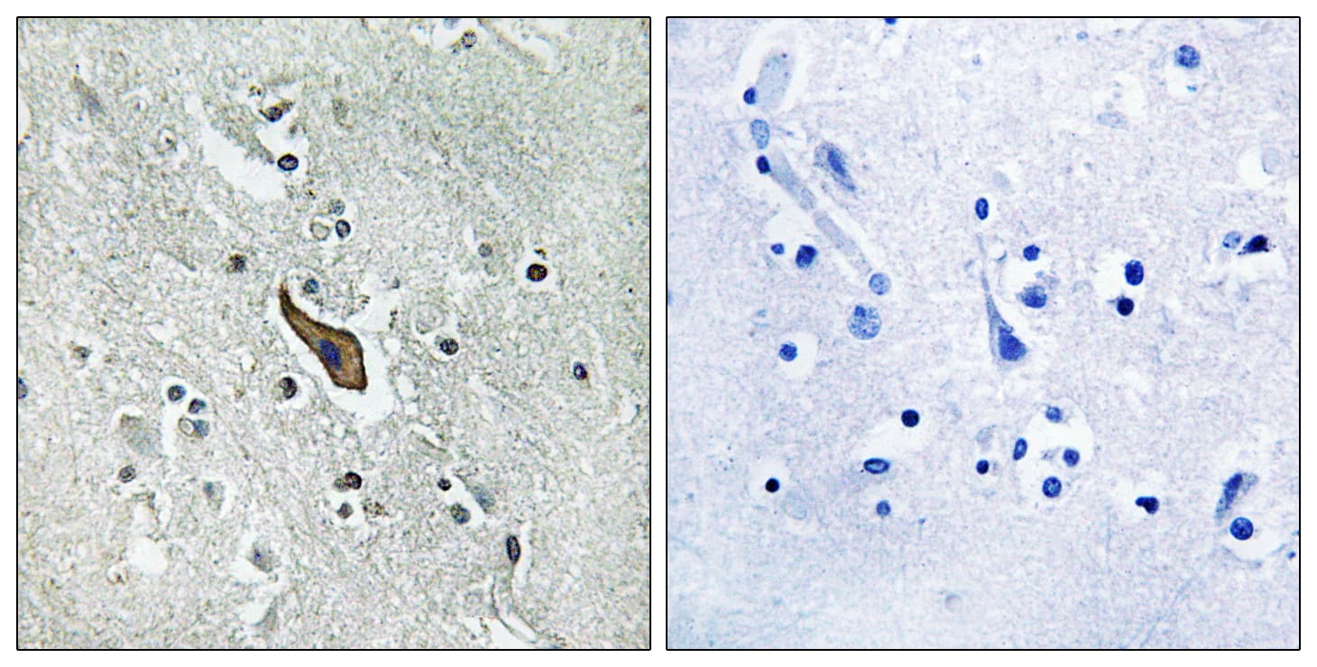 ROBO2 Antibody (aa237-286)