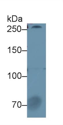 F5 / Factor Va Antibody (aa1908-2203, Biotin)