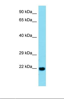 Polyclonal Rabbit anti-Human BTBD2 Antibody (C-Terminus, WB)