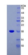Human SST / Somatostatin Protein (Recombinant His-S)