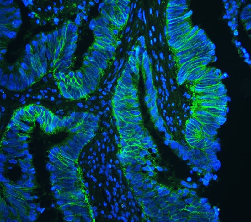 Basigin / Emmprin / CD147 Antibody