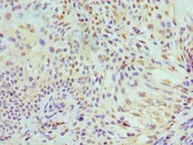 MCM7 Antibody (aa360-719)