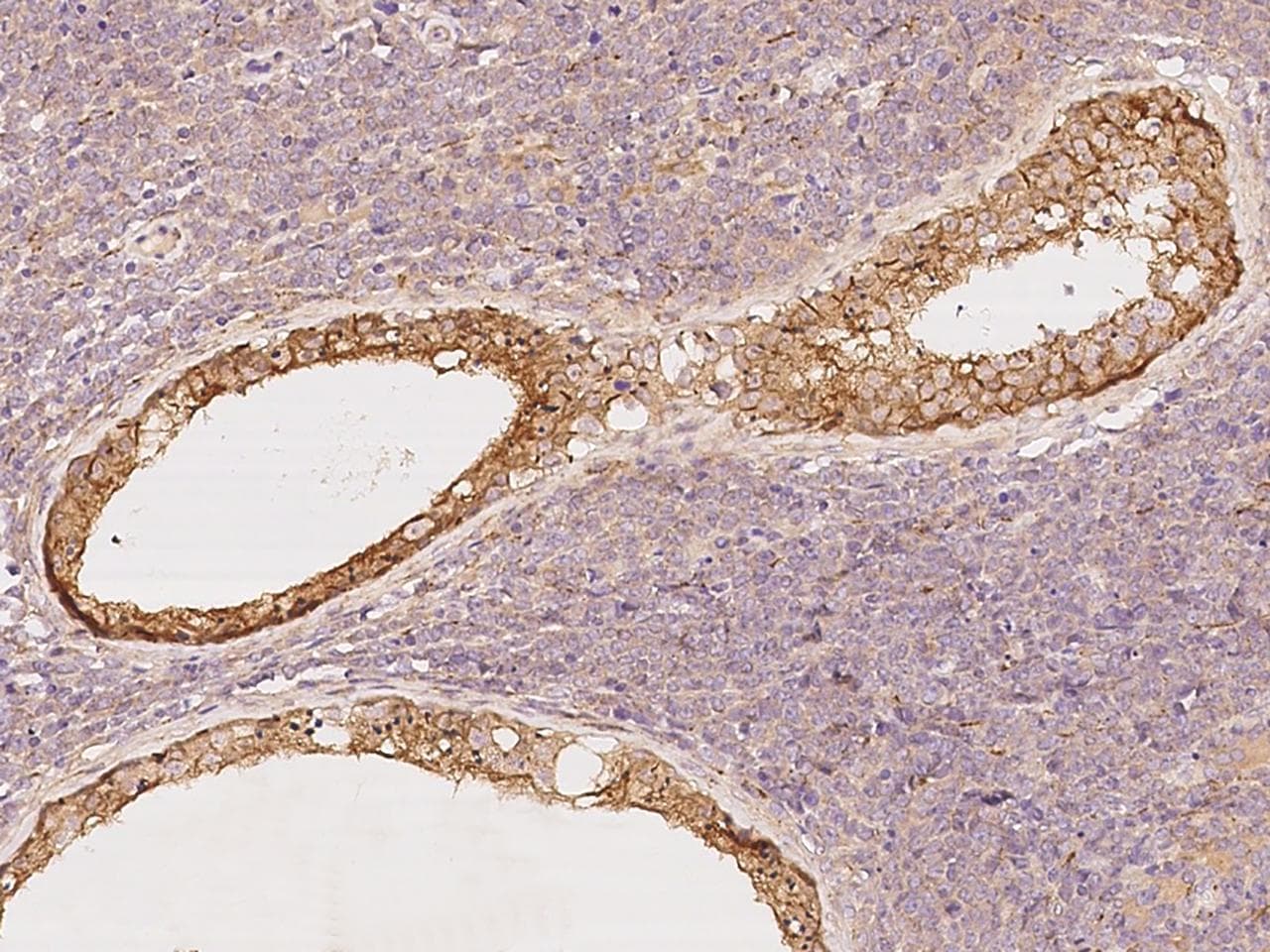 GPR180 Antibody