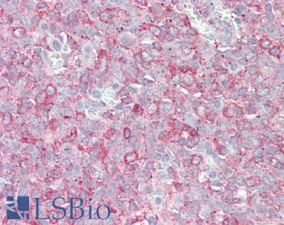 IHC-plus™ SIPA1L3 Antibody (aa1-50)