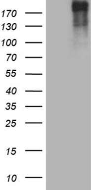 POLR2A / RNA polymerase II Antibody (aa1351-1614, clone OTI1E5)