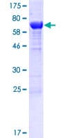 Human TLDC1 / KIAA1609 Protein (Recombinant GST)