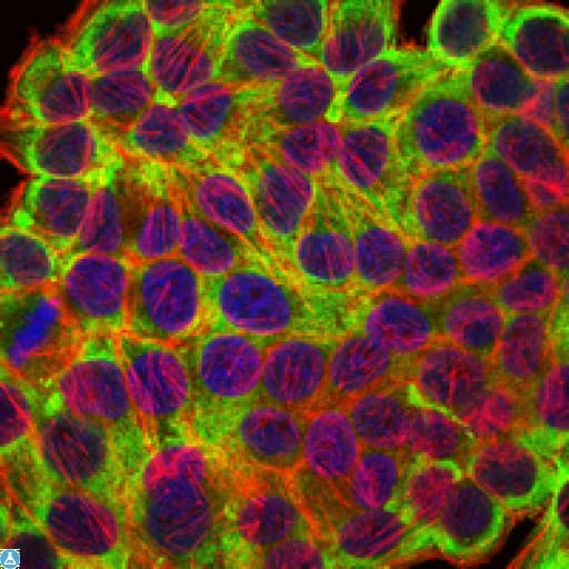 KRT19 / CK19 / Cytokeratin 19 Antibody