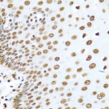 HNRNPR / hnRNP R Antibody