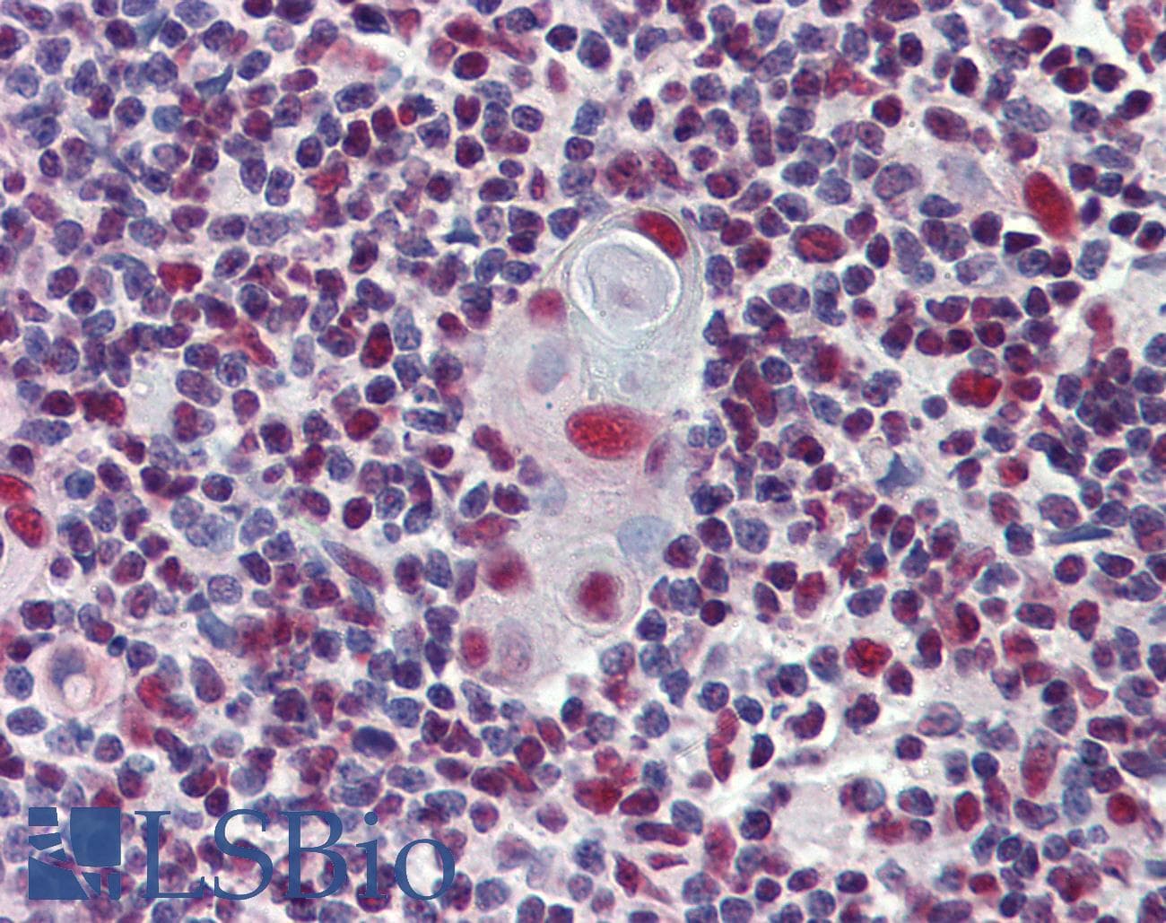 IHC-plus™ Polyclonal Rabbit anti-Human HDAC1 Antibody (IHC, IF, WB)