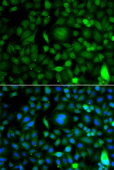 DPF1 / Neuro-D4 Antibody