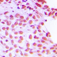 FEN1 Antibody (Internal)