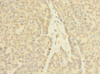 ASZ1 / Orf3 Antibody