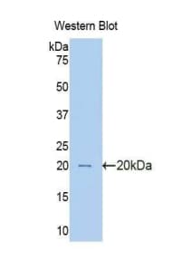 PIM1 / Pim-1 Antibody (aa122-261, PE)